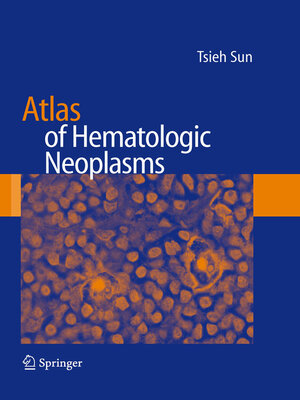 cover image of Atlas of Hematologic Neoplasms